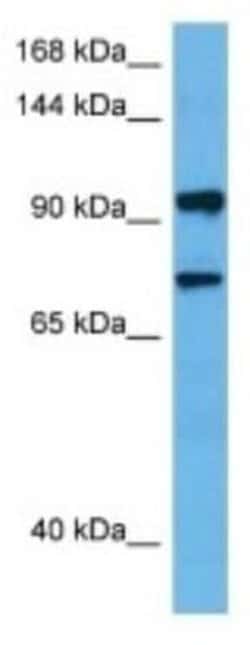 BICD1 Rabbit anti-Human, Polyclonal, Novus Biologicals 100 &mu;g | Buy Online | Novus Biologicals | Fisher Scientific